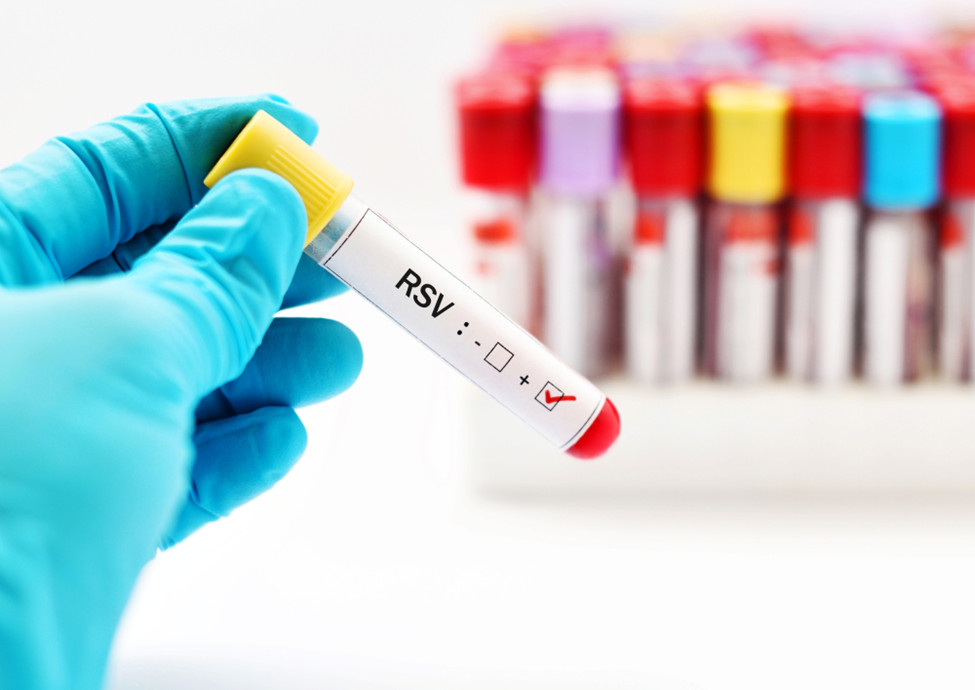 FDA Issues EUA for Combined Test for COVID-19, RSV, Influenza